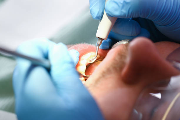 Best Emergency Wisdom Tooth Extraction in Newk, AR