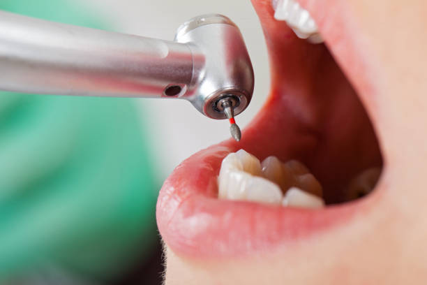 Best Emergency Dental Care for Sports Injuries in Newk, AR